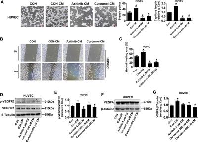 Curcumol repressed cell proliferation and angiogenesis via SP1/mir-125b-5p/VEGFA axis in non-small cell lung cancer